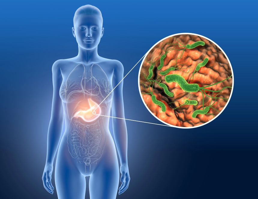 Mastichával történő gyógyítás, helicobacter pylori