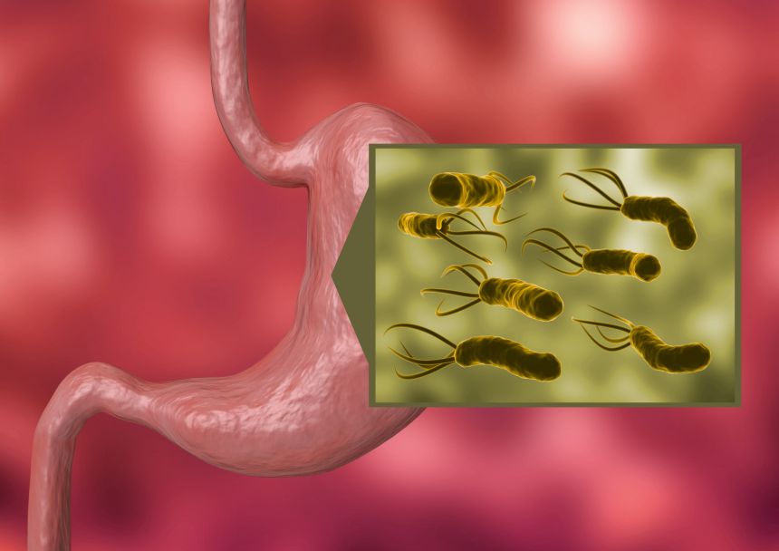 természetes antibiotikum maszticha